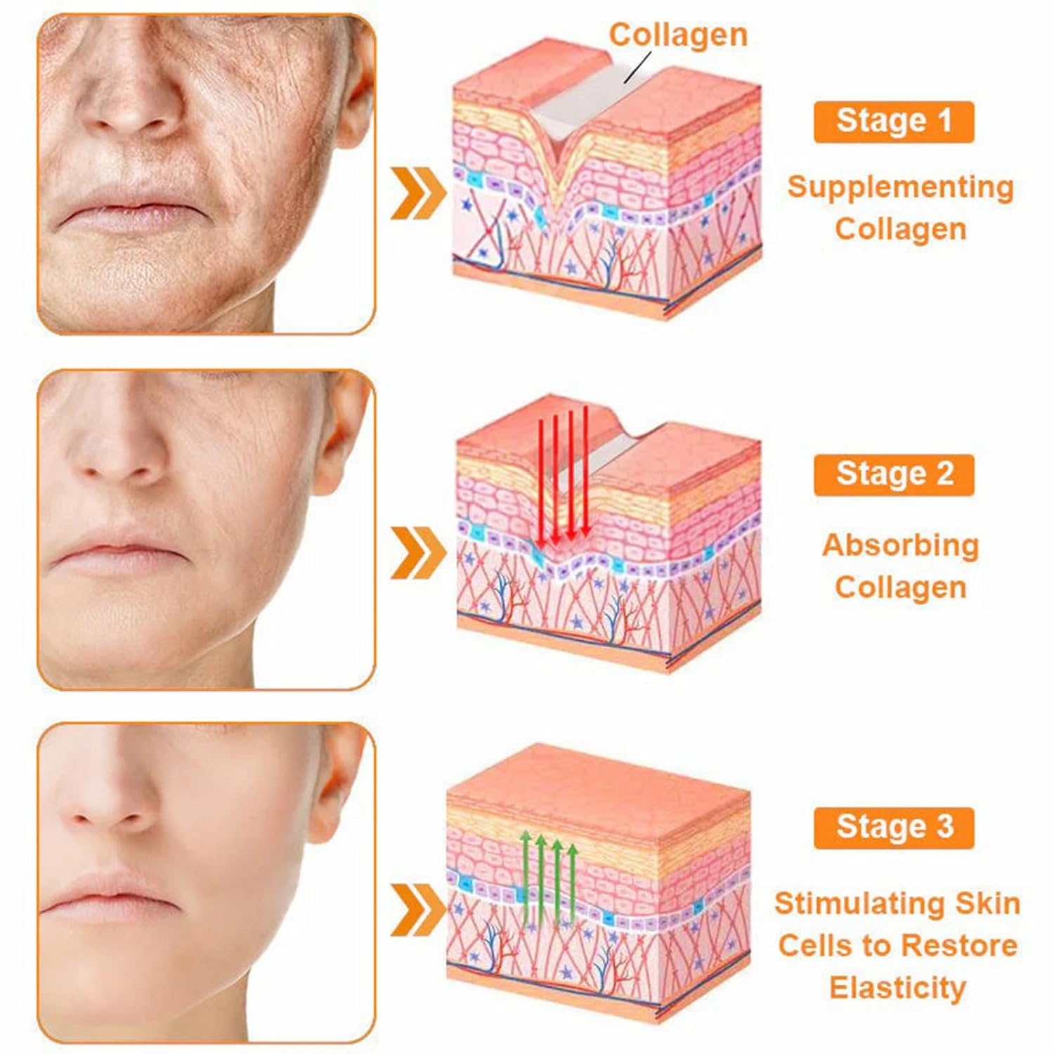 Bee Venom All-in-One Cream,Bee Venom Skin Treatment Cream,Hydrates skin and reduces blemishes (4PCS)