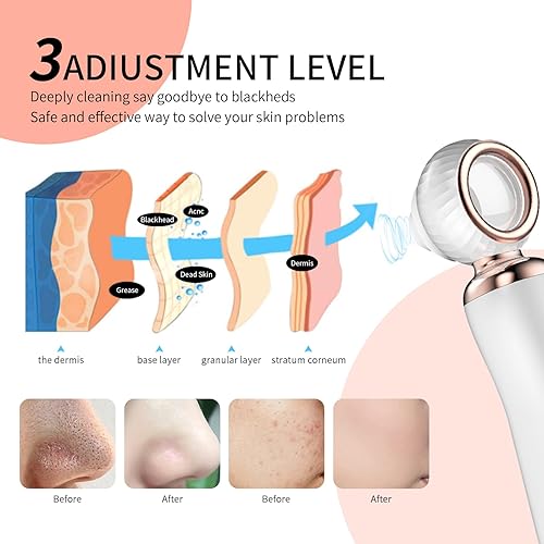 Miniatura 4 de 2025 - Aspiradora de poros para eliminar puntos negros, limpiador de poros facial recargable visual, 3 succiones de silicona suave, 3 sondas, kit