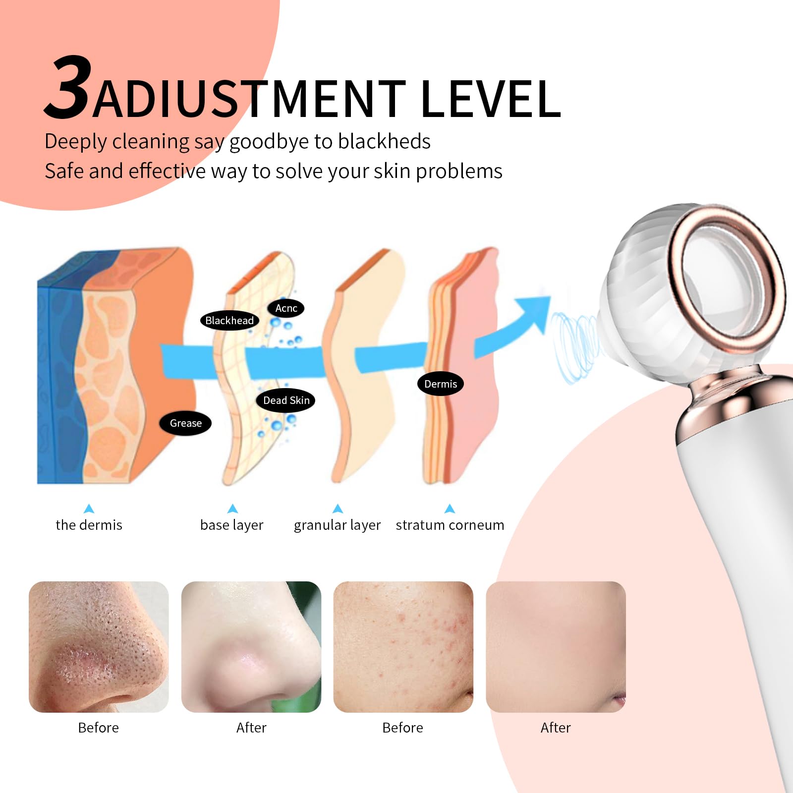 Amazon.com: 2025 Blackhead Remover Pore Vacuum, Visual