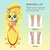 Vista 3 de Kids Orthotic Cushioning Arch Support Shoe Insoles, Children Support Insole for Comfort,Flat feet, Plantar Fasciitis, Feet Heel Pain Relief