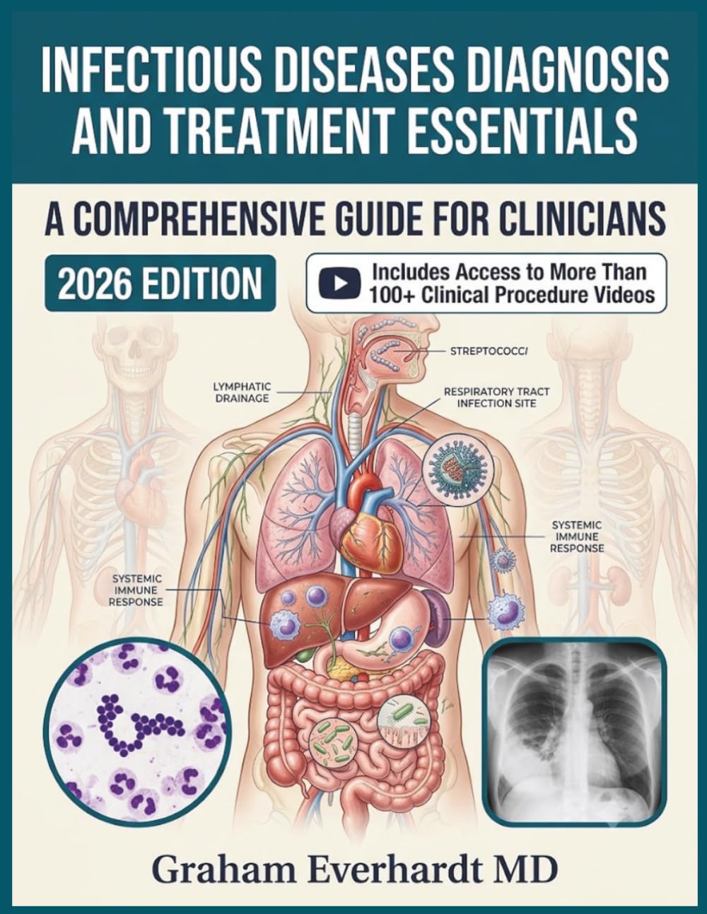 INFECTIOUS DISEASES DIAGNOSIS AND TREATMENT ESSENTIALS: A Clinical Guide to Antimicrobial Therapy, Stewardship, and Evidence-Based Management