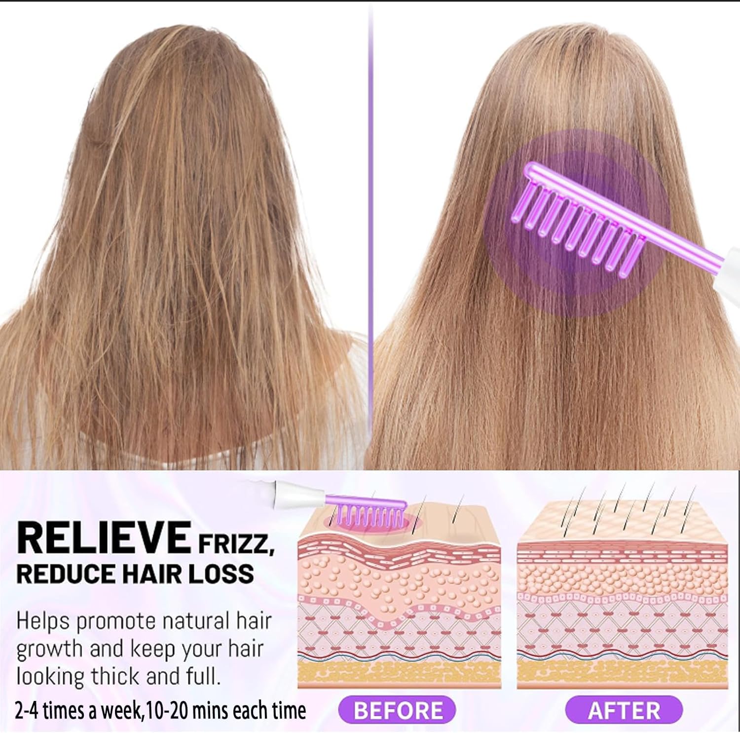 High Frequency Facial Wand,Portable Handheld High-Frequency Facial with 4 Argon Sticks - Violet (4 Violet Tubes) - Image 3