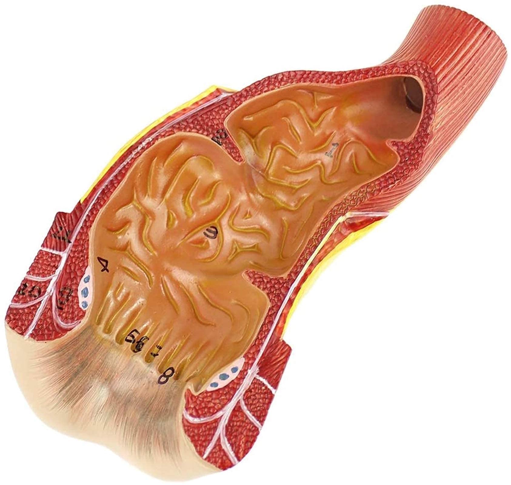Buy Anatomy Model, Anatomical Human Rectal Anal Canal Model Anorectal
