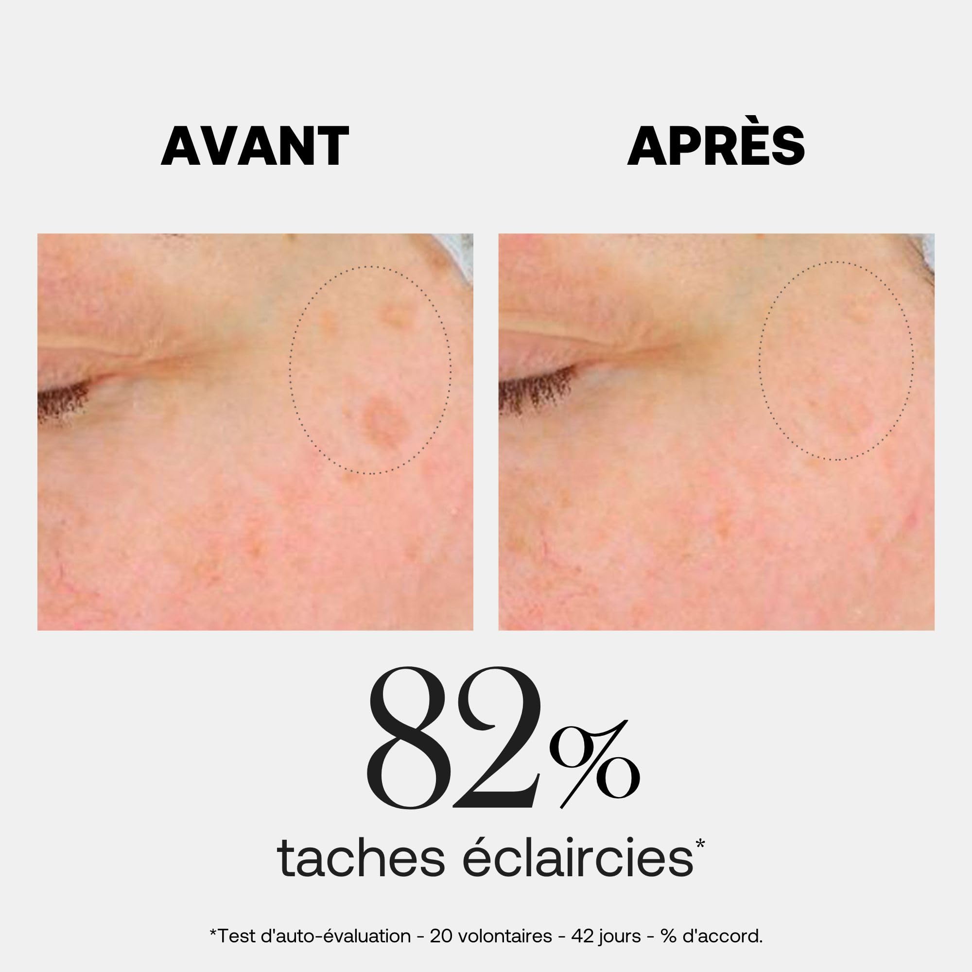 Rexaline Crystal Bright Sérum – Sérum Anti-Taches & Éclat – Acide Hyaluronique RX2, Acide Gallique & Niacinamide – Teint Unifié & Lumineux – Tous Types de Peaux – 30ml