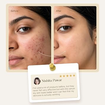 Snail Mucin Serum