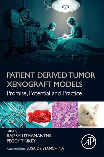 Patient Derived Tumor Xenograft Models: Promise, Potential and Practice
