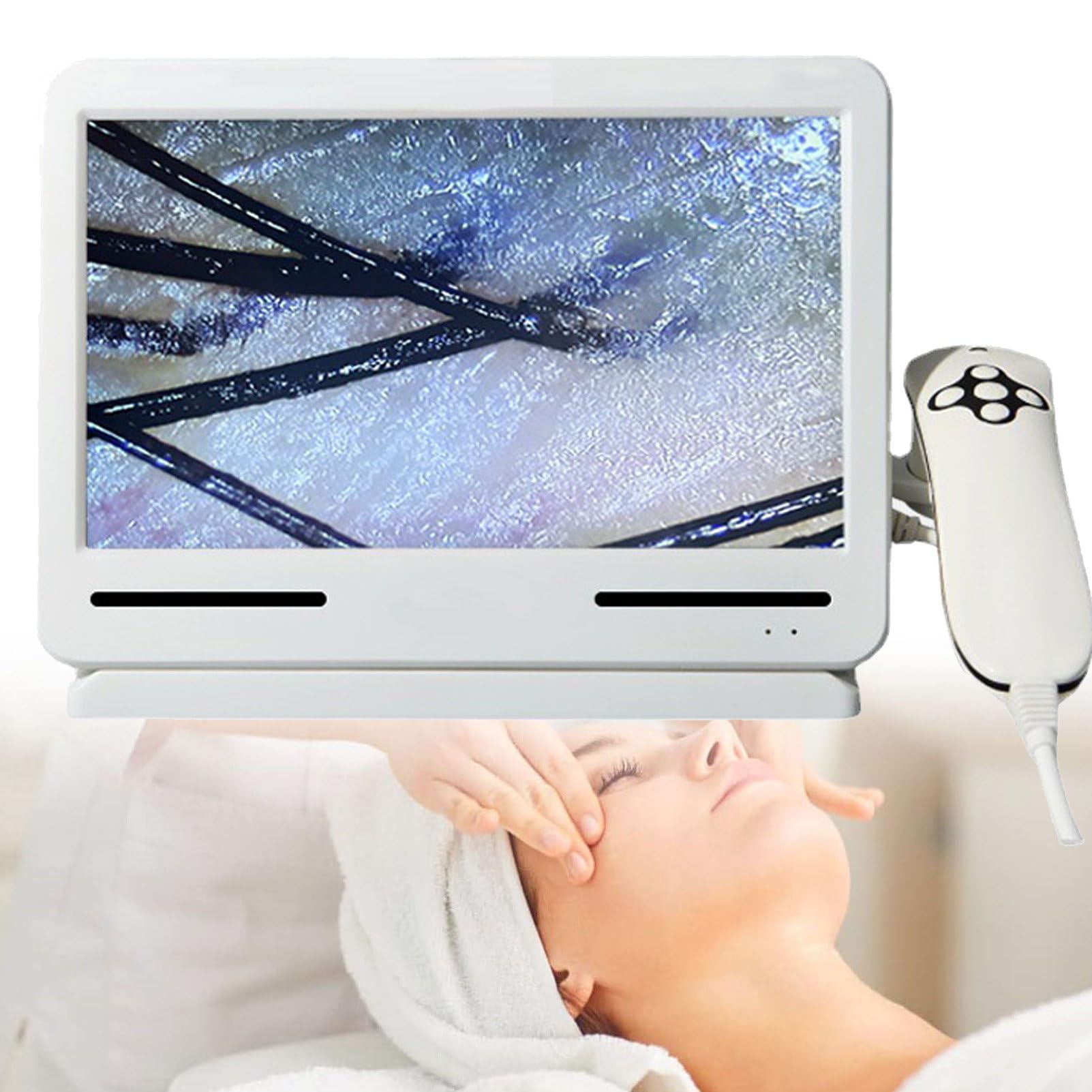 Analizzatore Professionale per Capelli per Diagnosi Cutanea, Rilevatore di Cuoio Capelluto, Microscopio per Capelli, Rilevatore di Pelle/Follicoli Piliferi/Cuoio Capelluto
