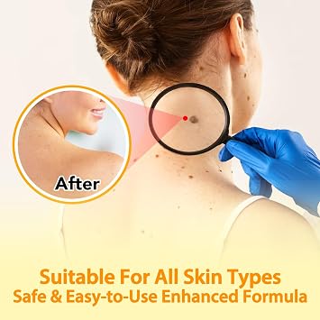 A r b c r n Bee Venom Cream for Face & Body Hydrating Moisturizing Cream for Dry Skin, Soothing Lotion 3.52 oz