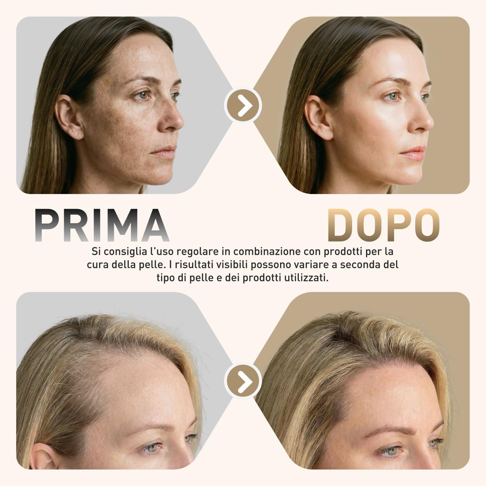 Dr. pen H6 Microneedling Pen – Nuovo Modello 2026 | Regolabile da 0 a 2,0 mm, 6 Velocità, Controllo Chip e Capacità Massima di 1000 mAh, Ideale per Saloni Cosmetici e a Casa (oro)