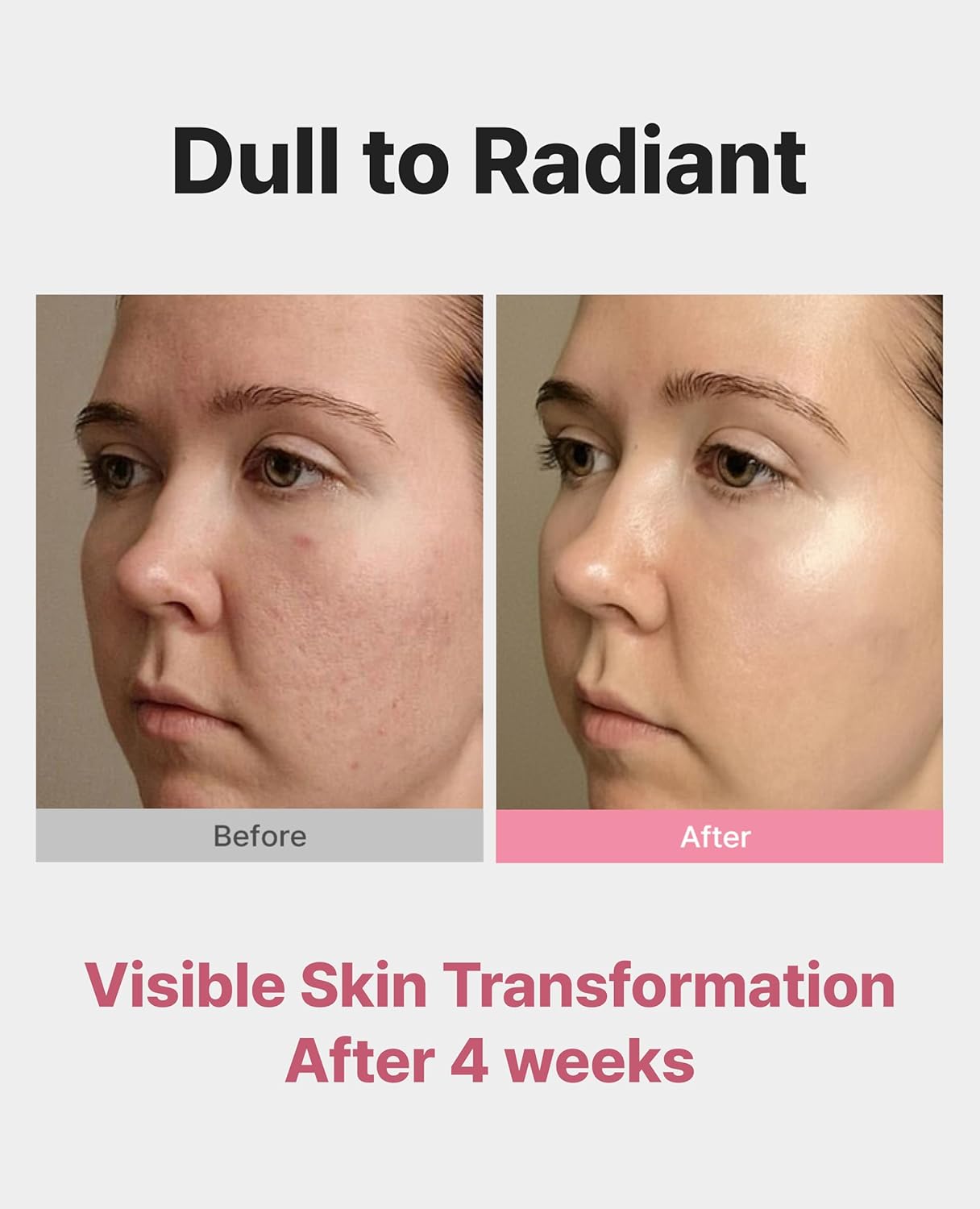 Delere Caviar AHA 3% Glow Toner | Korean Collagen Exfoliating Toner | Korean Exfoliator for Radiance, Collagen Skin Care, 250ml - Image 2