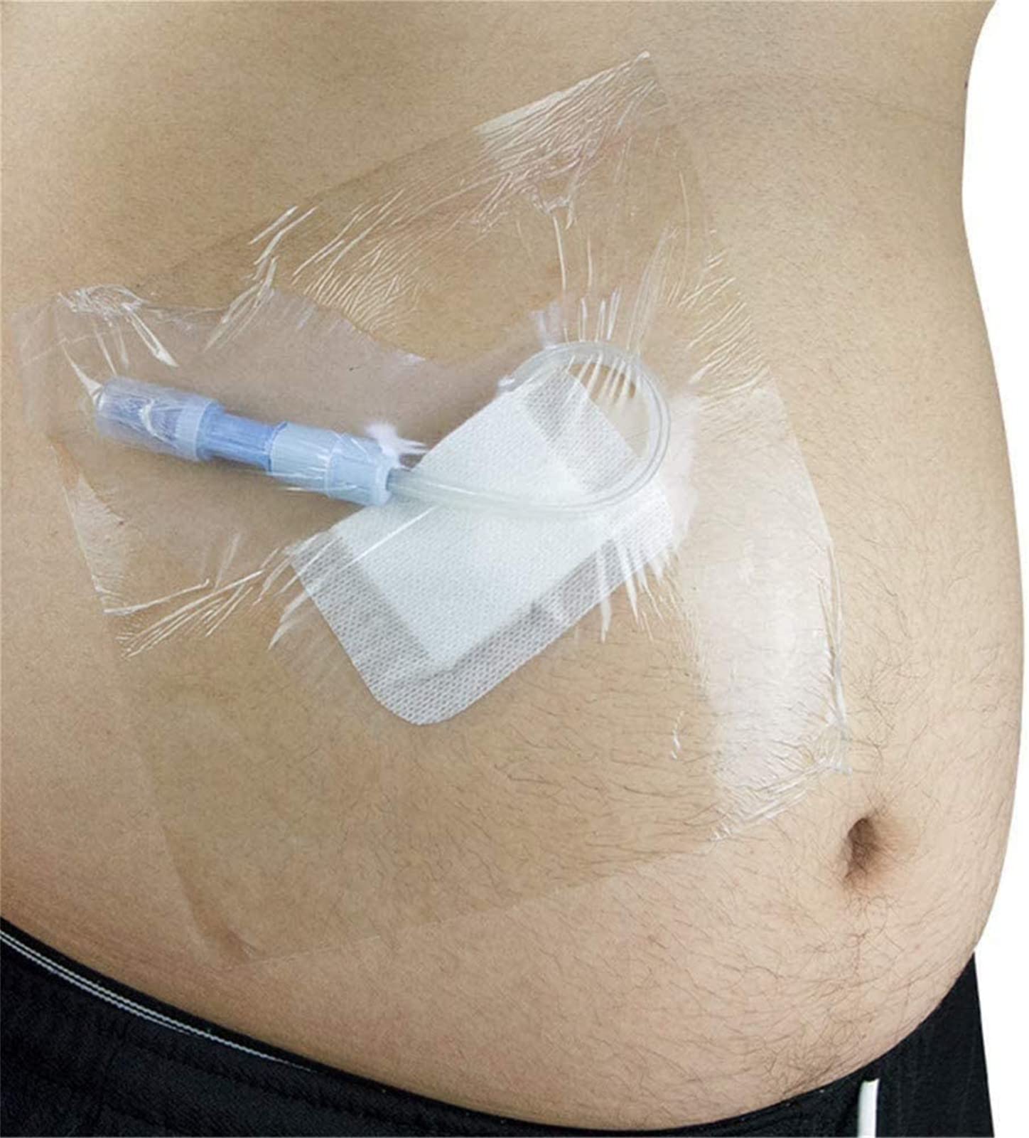 Lot de 100 Bandes de Fixation jetables imperméables péritonéales, Patch de Bain pour dialyse péritonéale, Couverture de Douche étanche postopératoire, Produits de Soins(Color: 10 * 10cm)