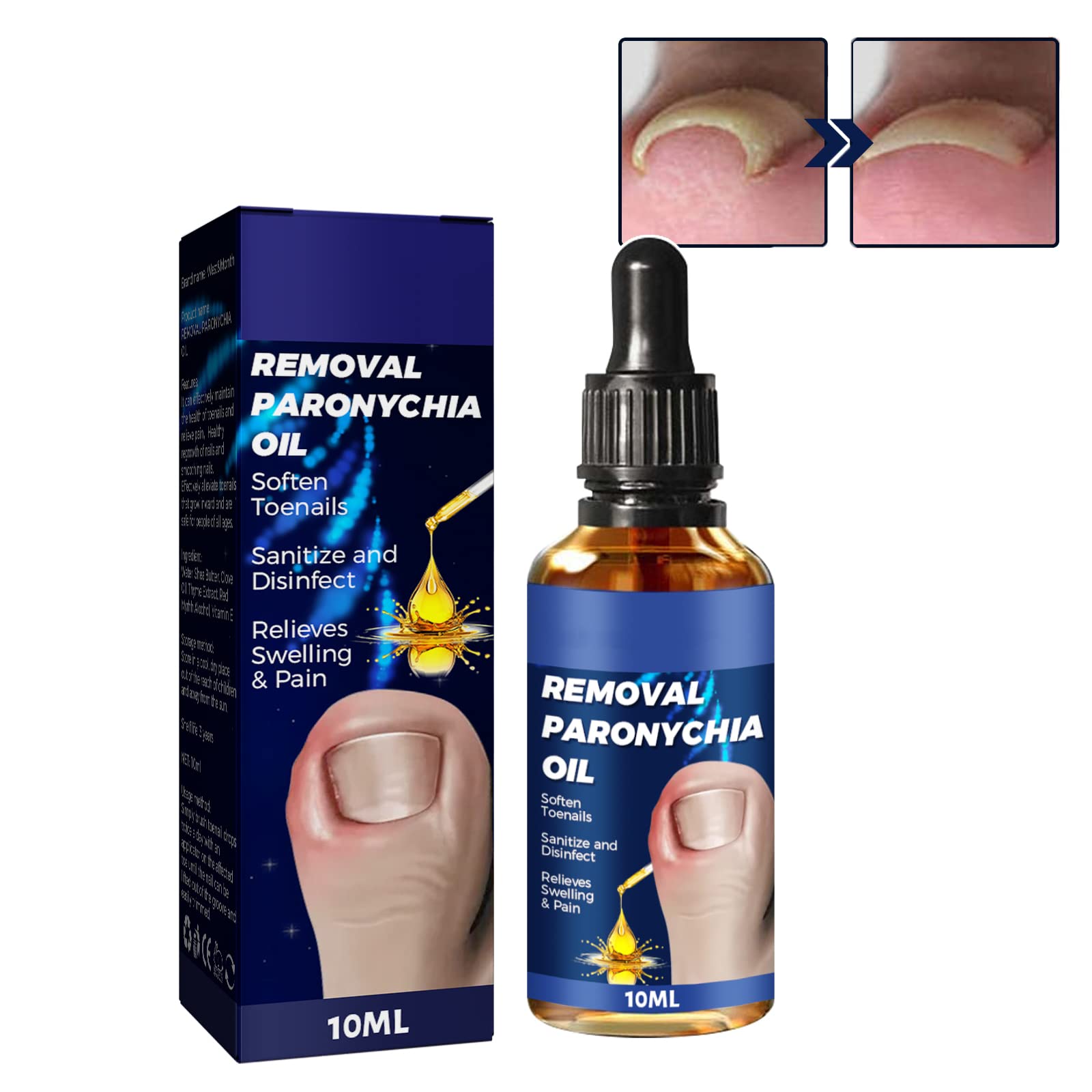 German Toenailcare Removal Paronychia Oil - German Toenailplus Anti Paronychia Relief Oil, Toenail Softener Toe and Fingernail Repair for Damaged Discolored Thick Nails (1PCS)