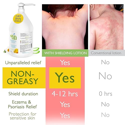 Miniatura 2 de Loción protectora natural para la cara Skin MD, cuerpo y manos, ayuda con eczema y psoriasis El remedio natural a las cosas que secan tu piel