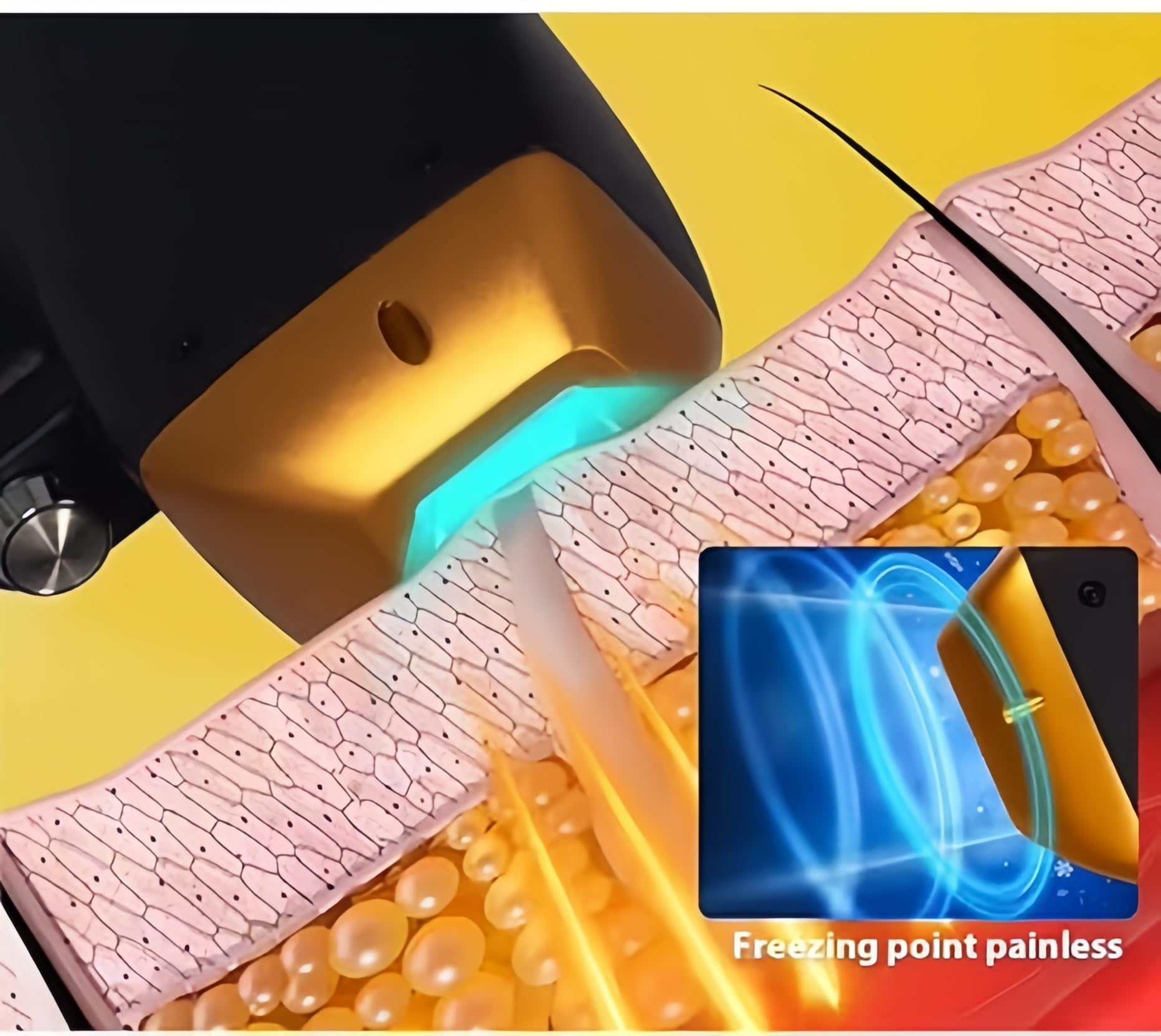 Nuovo Laser a Diodo 808 nm con Manico di Ghiaccio, Dispositivo per Epilazione Indolore, Multifunzione per Centri Estetici, Apparecchiature Professionali per la Casa