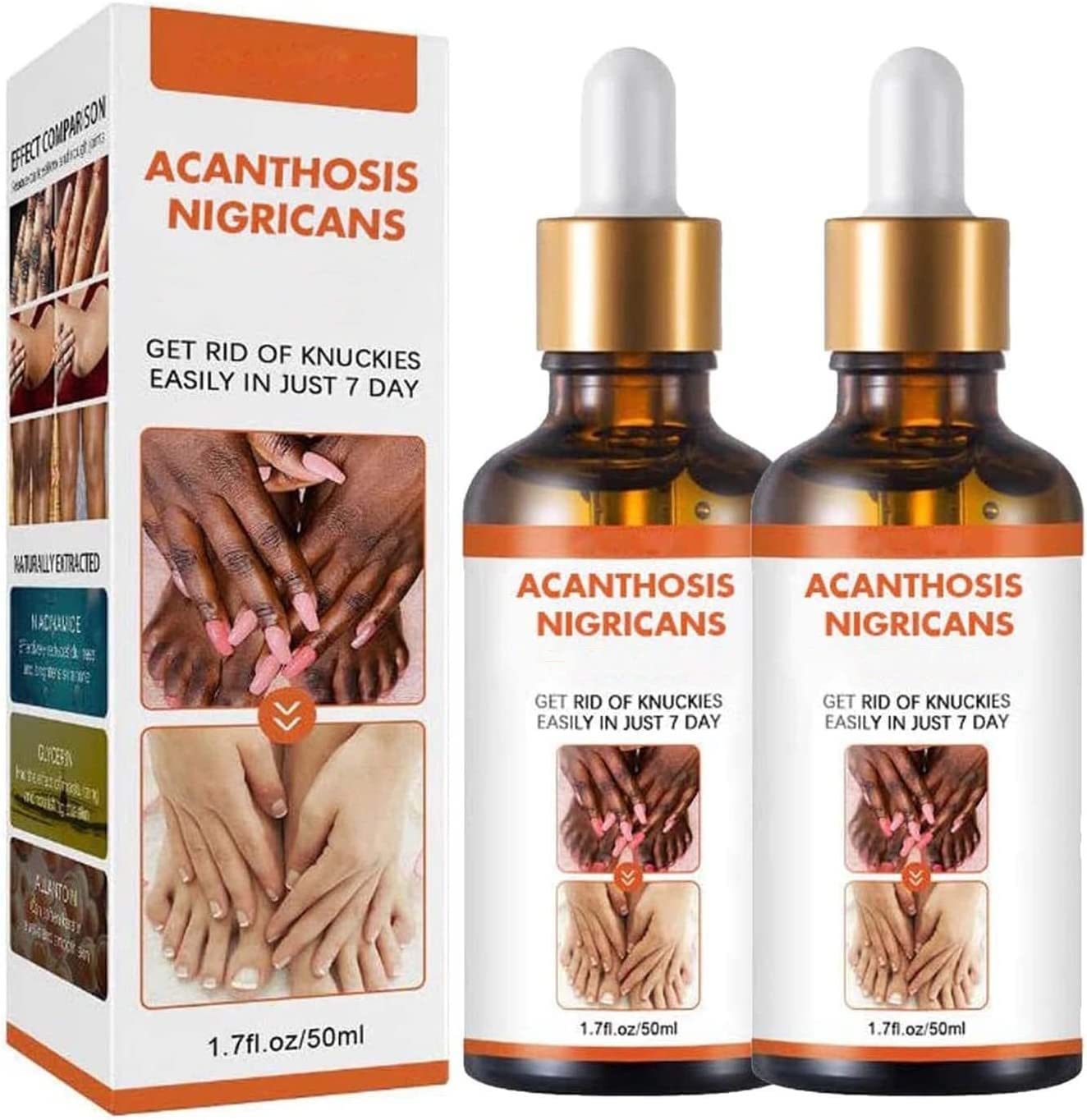 Acanthosis Nigricans Therapy Oil, Dark Spot Corrector Oil, Acanthosis Nigricans Treatment, Dark Spot Remover Lighten Body Black Skin, Removing Dark Knuckle Finger Elbow (2pcs)