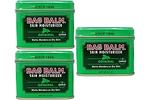 Vermont’s Original Bag Balm Original Skin Moisturizer: 3 Pack of 8oz Tins...