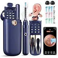 Ear Wax Removal, Ear Cleaner with Camera 1296P HD,Visual Ear Cleaner with 6 LED Lights and Flexible Tip,FSA HSA Eligible Items,Safe Ear Wax Removal Kit with Camera,Ear Cleaning Tool for Family Gifts