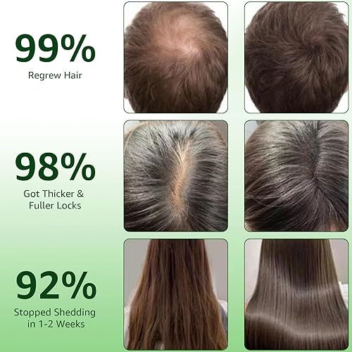 Miniatura 2 de Sistema de crecimiento del cabello, suero avanzado para el crecimiento del cabello con biotina, ginseng, eclipta prostrata, menta y raíz de jengibre