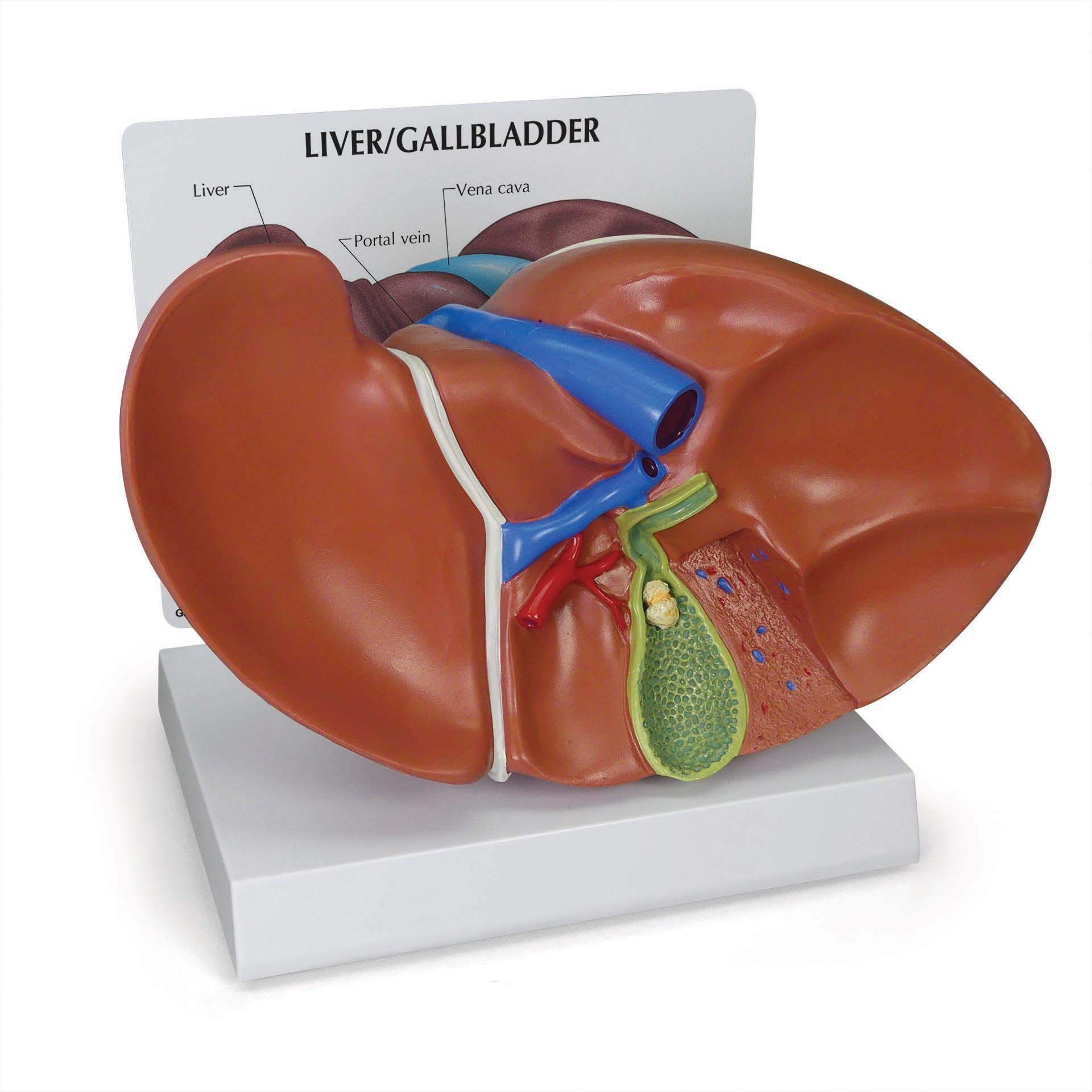 The Human Gallbladder
