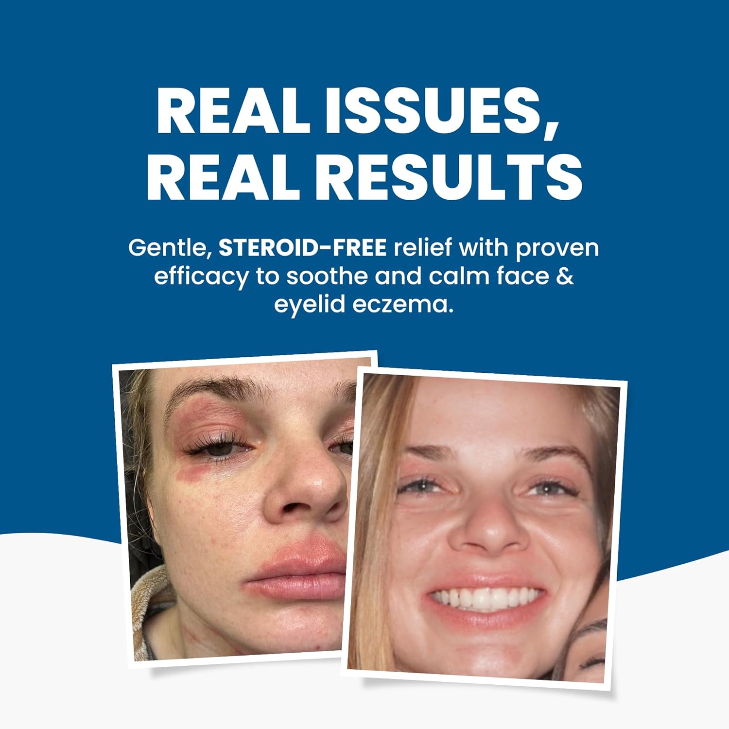 Grahams Natural Face & Eyelid Oil - For Very Dry Skin Around Eye & Face, Eczema & Perioral Dermatitis - Steroid-Free, Hypoallergenic, Non-Comedogenic - 100% Pure - with Argan & Jojoba Oil (1.69 Fl Oz) - Image 2