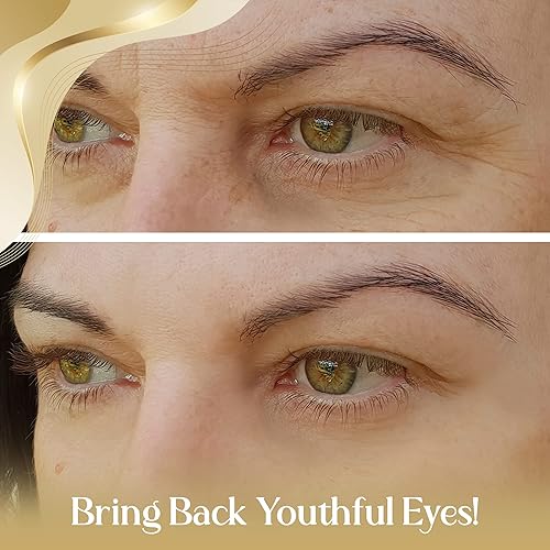 Miniatura 2 de OROGOLD Suero intensivo para ojos 24K - Suero debajo de los ojos para ojeras, hinchazón - 1.76 onzas líquidas