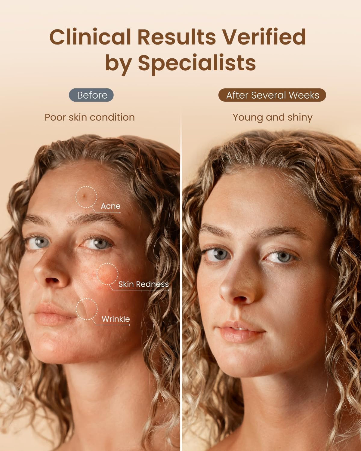 RENPHO 4D Red Light Therapy Mask for Face 2026, Valentines Day Gifts for Women Mom Wife, 324 LEDs Full Face Coverage & 3 Light Modes, Cordless LED Red Light Therapy Face Mask for Home Use & Travel - Image 4