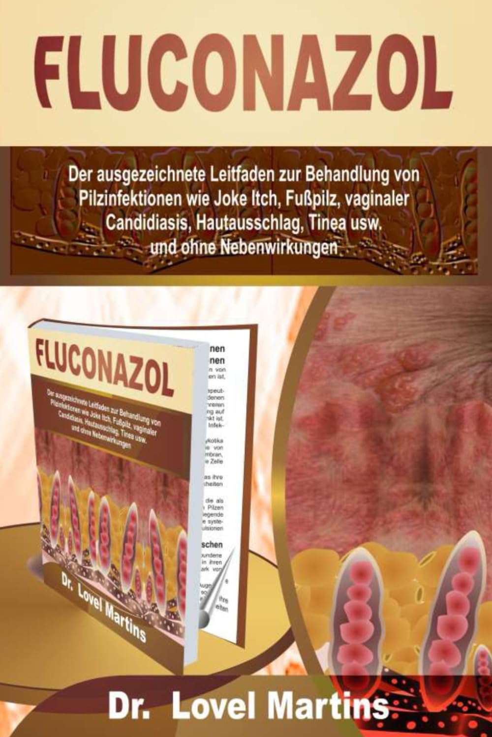 Fluconazol in deutschland