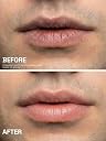 PROWL by Tiger Shroff SPF 50 PA+++ Lightening Lip Balm For Men | Kojic Acid gallery image