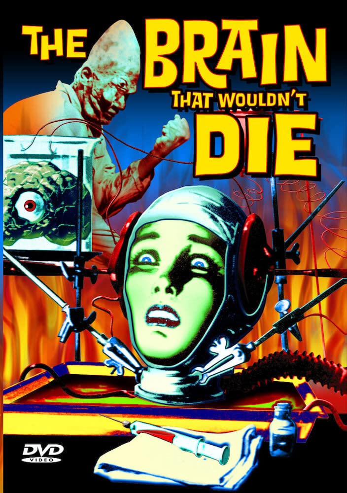 The Brain That Wouldn't Die: Amazon.ca: Linda Brent, Eddie Carmel