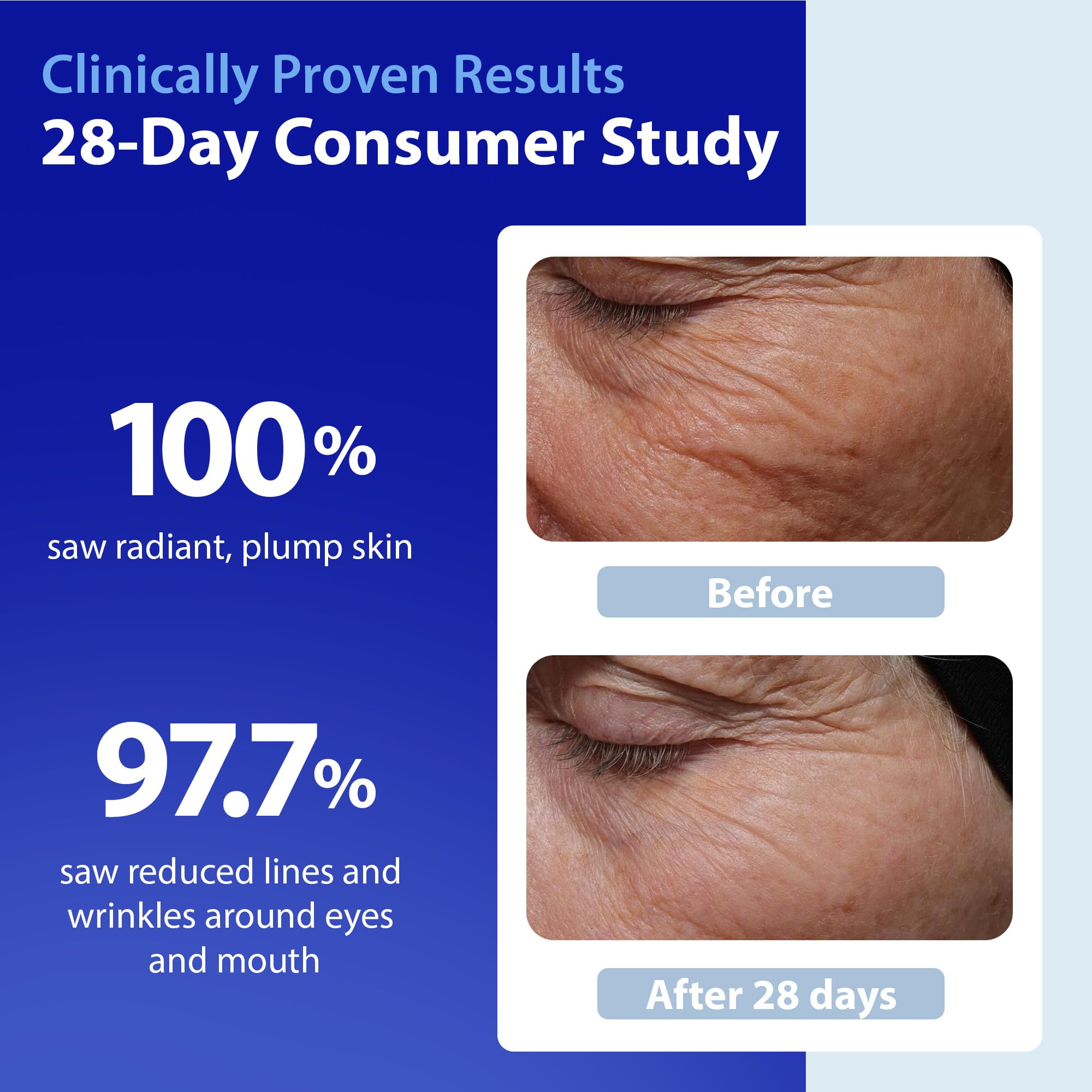 Dr. Denese HydroShield Retinol Serum for Face with Ceramides, 1 oz