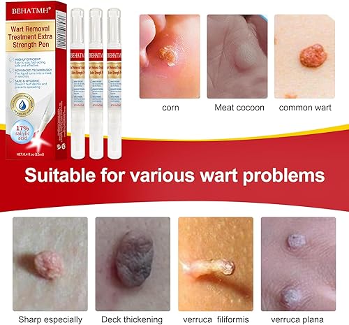Miniatura 4 de BEHATMH Paquete de 3 removedor de verrugas con punta de precisión, ácido salicílico de máxima resistencia para verrugas comunes y plantares,