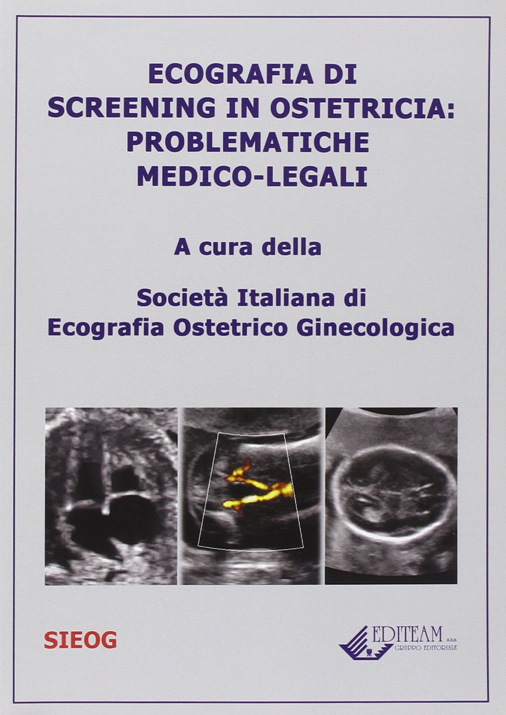 Ecografia di screening in ostetricia. Problematiche medico-legali