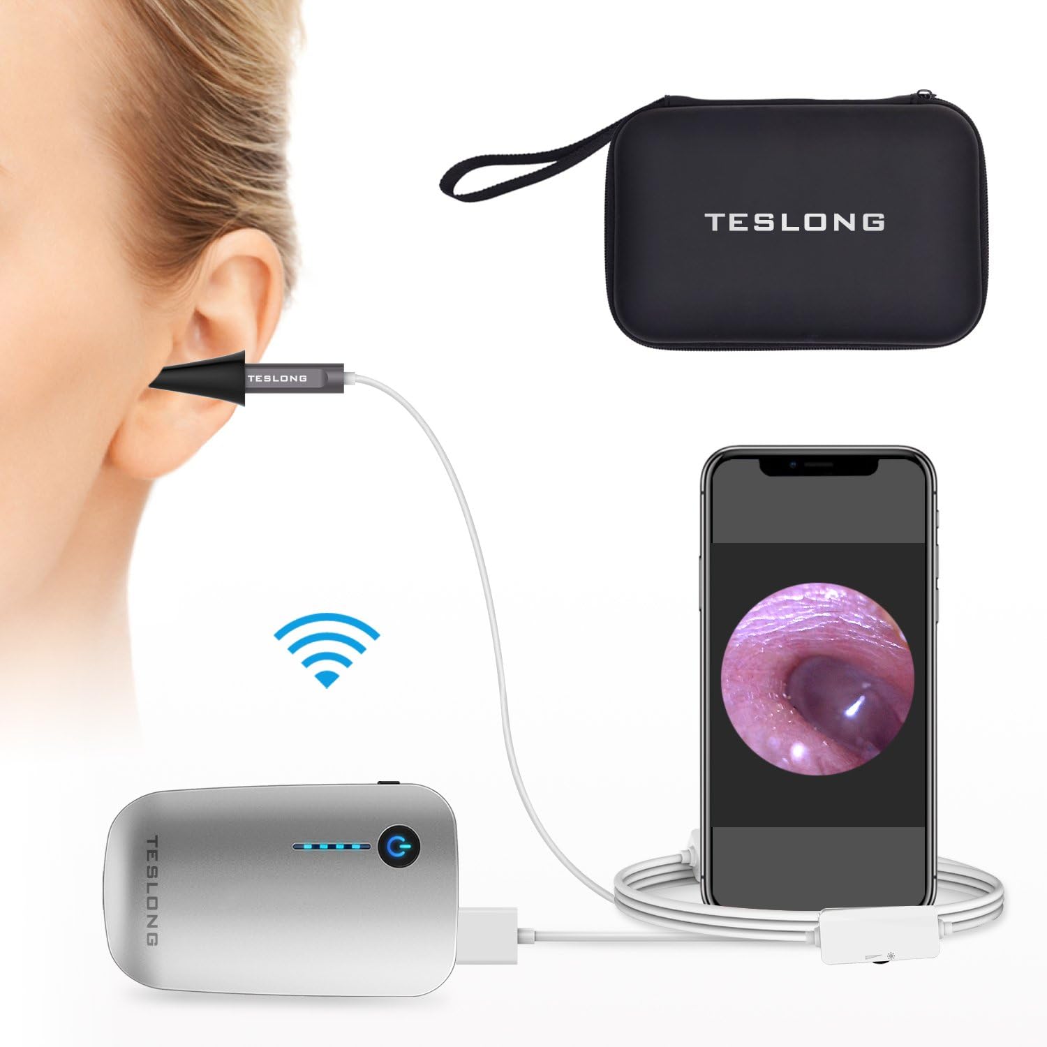 Teslong Wireless Otoscope, WiFi Ear Scope Ear Canal Eardrum Inspection Camera with Carrying Case for iOS and Android Smartphone, iPhone, iPad, Samsung, Tablet