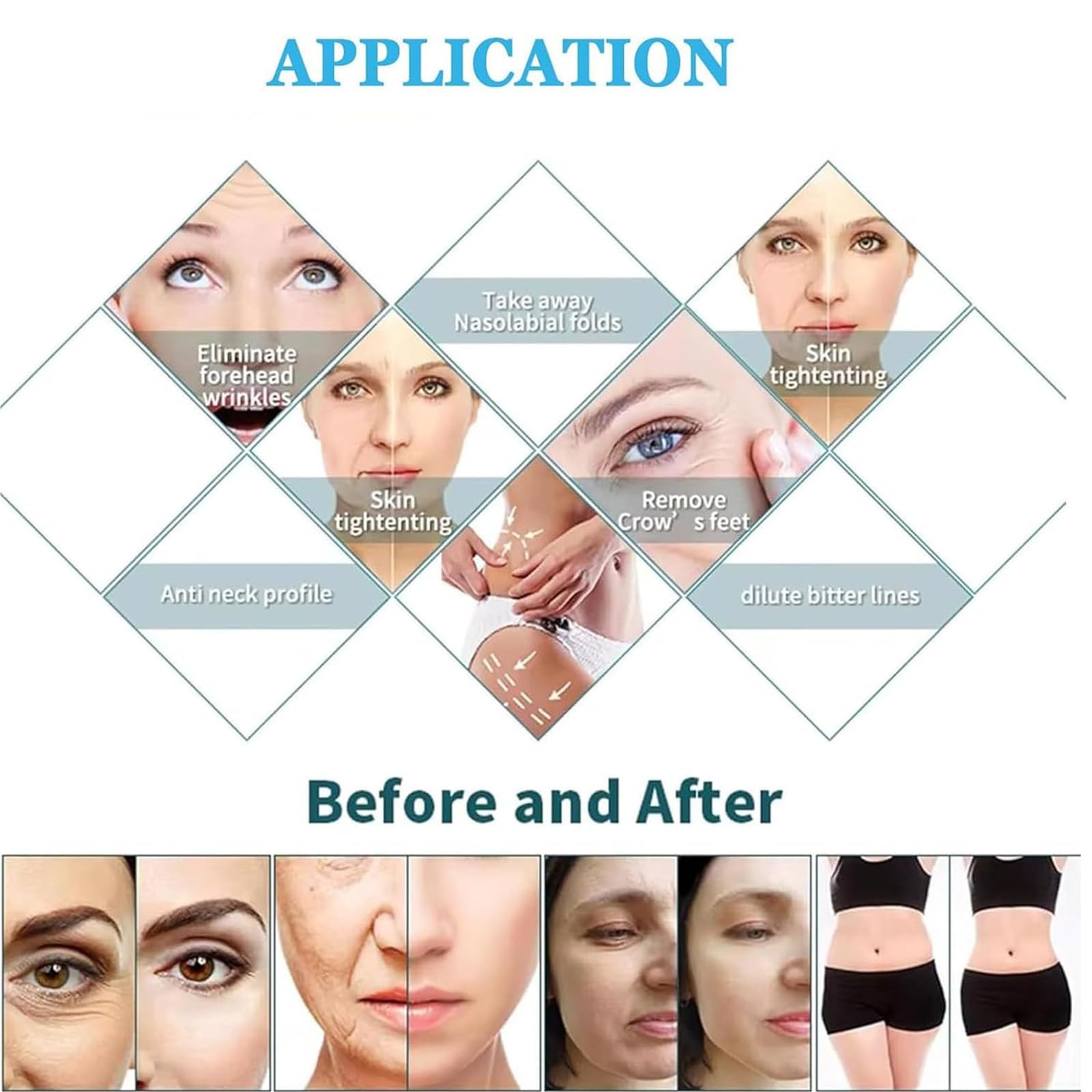 Machine Professionnelle Lifting Visage Microneedling RF Fractionné,Appareil Micro-Aiguilletage Fractionné Lifting Visage,Raffermissement Peau RF Fractionné 4 TêTes Et 2 PoignéE