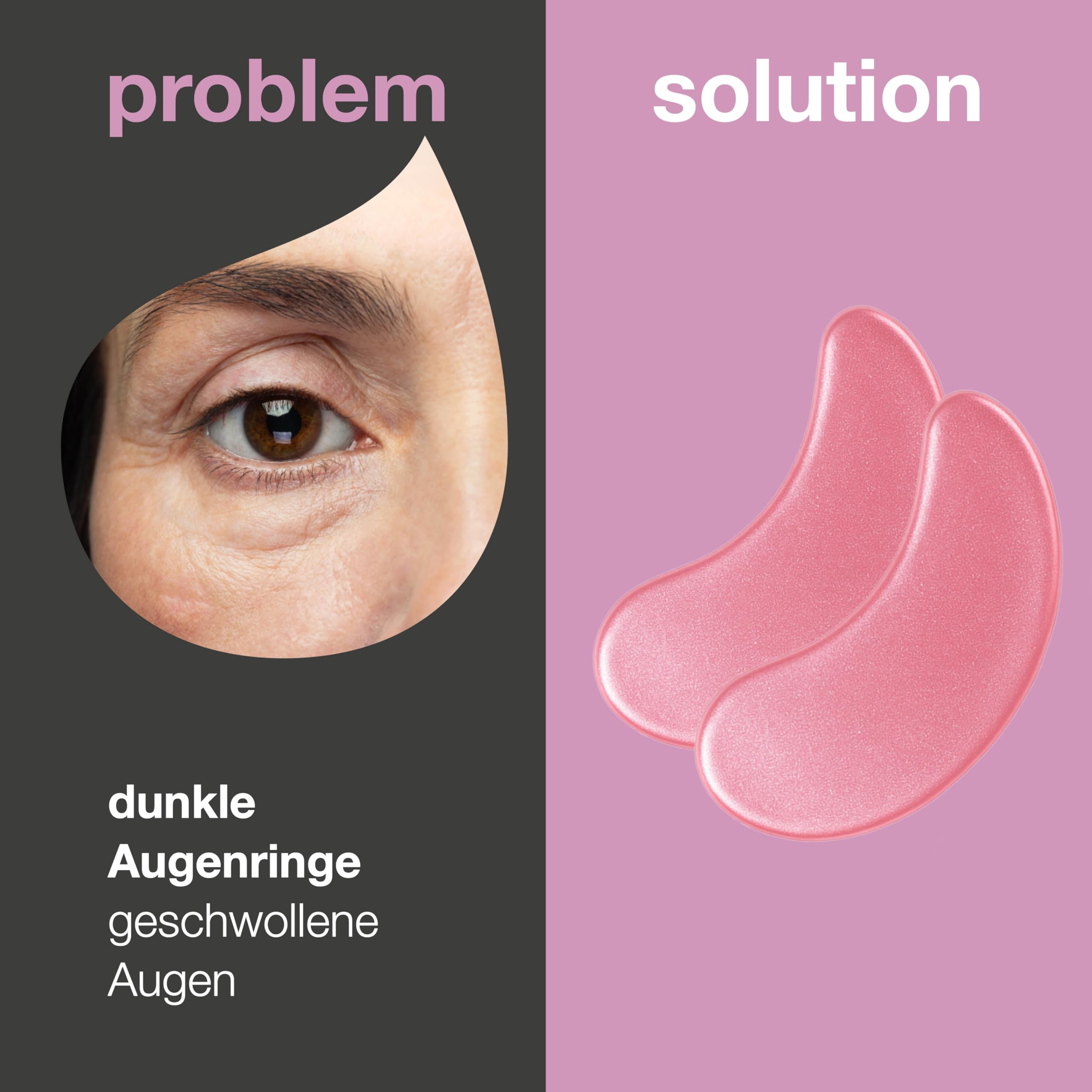 Vitamin B12 Augenpads gegen dunkle Ringe & Schwellungen (24er-Sets) – Mit B12, Hyaluronsäure & Kollagen für Feuchtigkeit & ein frisches Hautbild