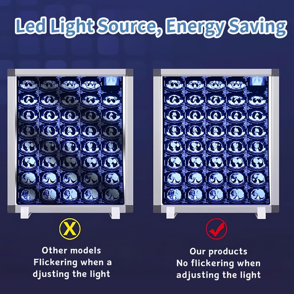 Illuminateur LED pour usage médical et dentaire, boîte de vue murale avec luminosité variable, fonctionnement sans ombre et sans scintillement