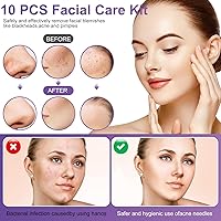 Vista 5 de Kit de herramientas para reventar espinillas, 10 unidades, removedor profesional de puntos negros, extractor de comedones para una fácil extracción