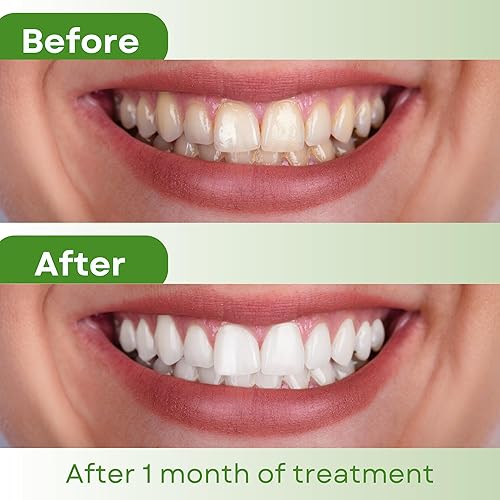 Miniatura 3 de Kagami Abera - Pasta dental natural, gran sabor, sin flúor, pasta dental blanqueadora, reductor de placa para dientes más brillantes y aliento