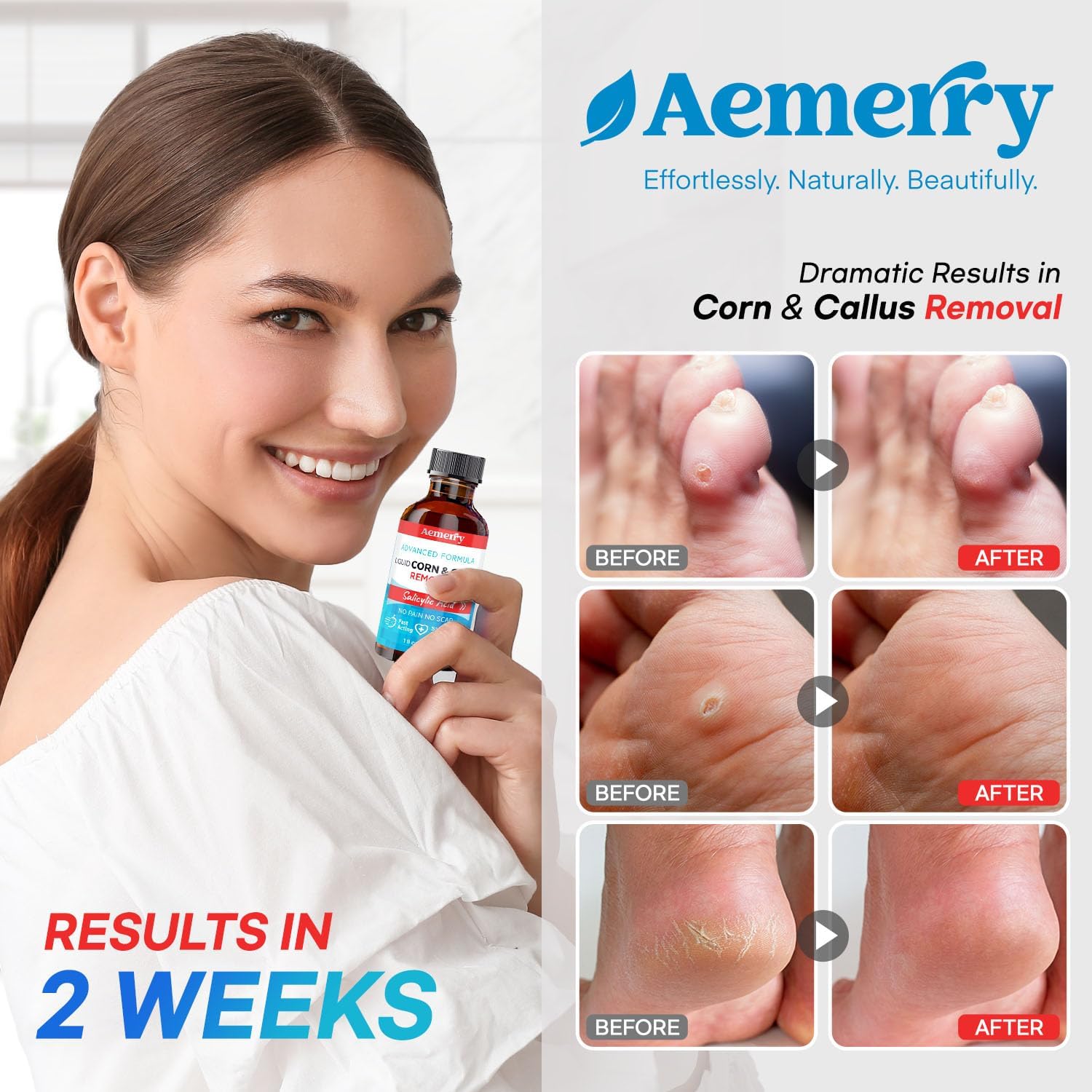 Corn Remover for Toes & Feet: Fast-Acting Corn Remover Liquid with 17% Salicylic Acid, Extra Strength Foot Corn Removal for Men and Women, With Precision Applicator, Suitable for All Skin Types. 30ml