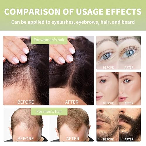 Miniatura 4 de Aceite de ricino prensado en frío para el crecimiento del cabello, aceite de coco, aceite de romero para el crecimiento del cabello con biotina,