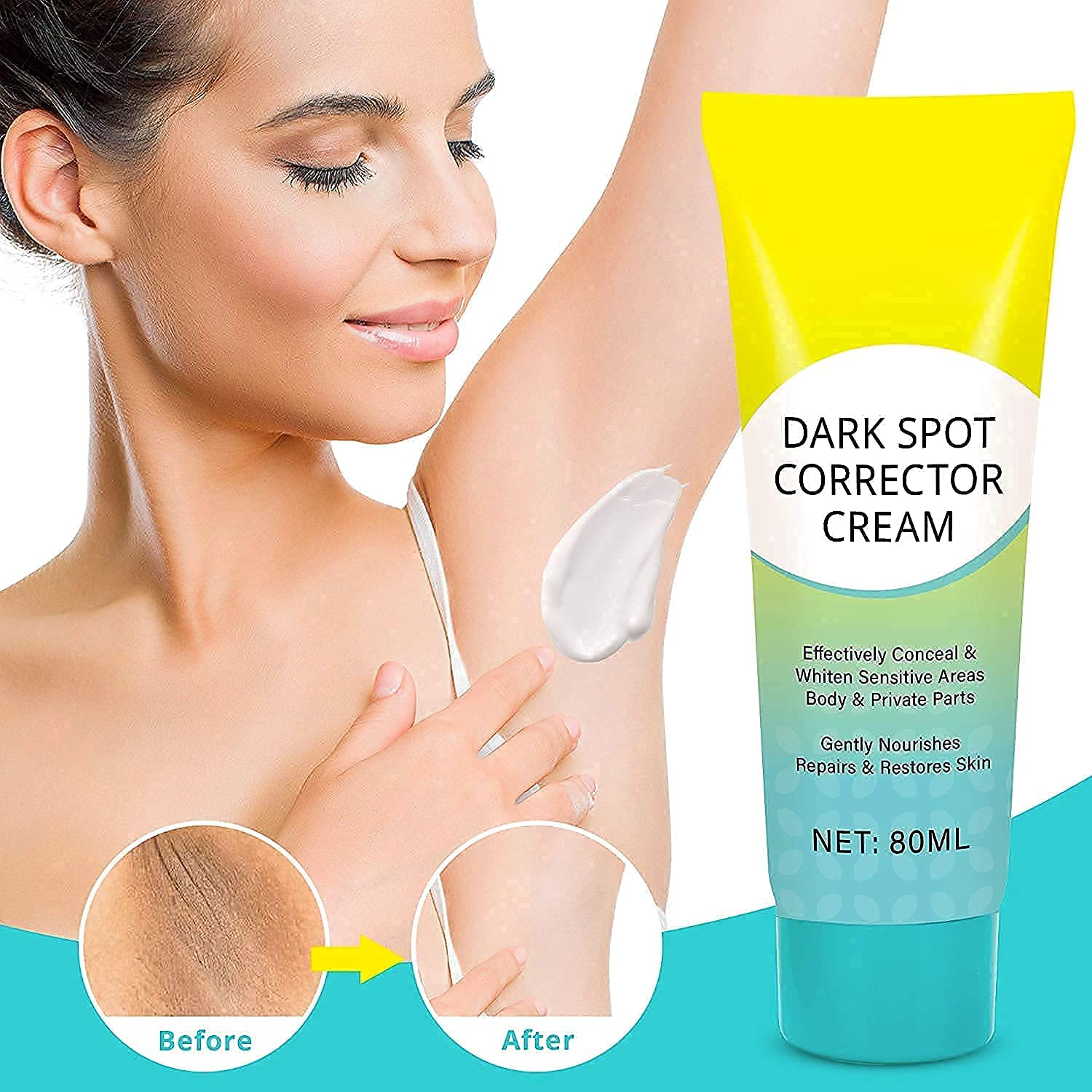 Dark Spot Remover for Body, K...B093RBPR61