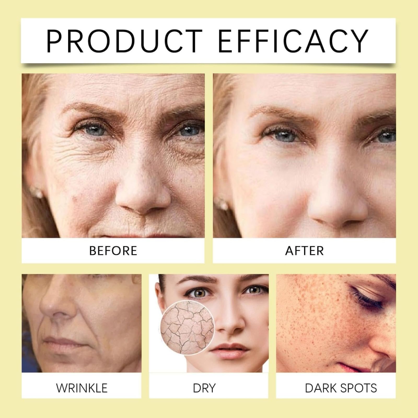 Crema para los ojos con retinol, para la cara y el cuello, reduce las ojeras, cuidado rápido de la piel, mujeres y hombres, adecuado para todos los tipos de piel, uso diurno por la noche. (5pcs)