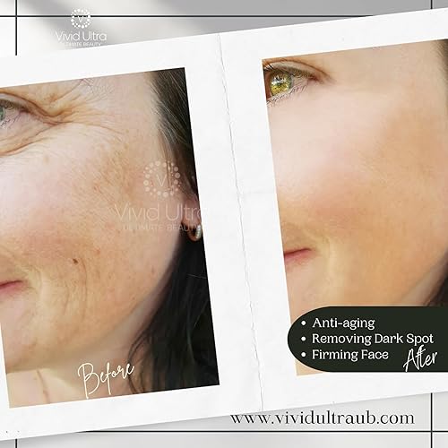 Miniatura 6 de Vivid Ultra Vitamina C Suero para la cara  Suero antienvejecimiento con ácido hialurónico, colágeno y vitamina E  Iluminando las manchas oscuras,