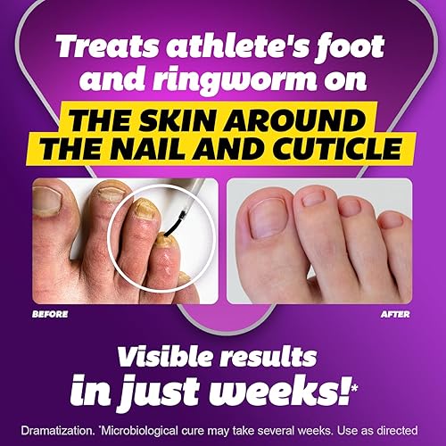 Miniatura 3 de SILKA Líquido antifúngico Max Strength para la salud de las uñas de los pies, con aplicador de cepillo, trata hongos, tiña y pie de atleta, restaura