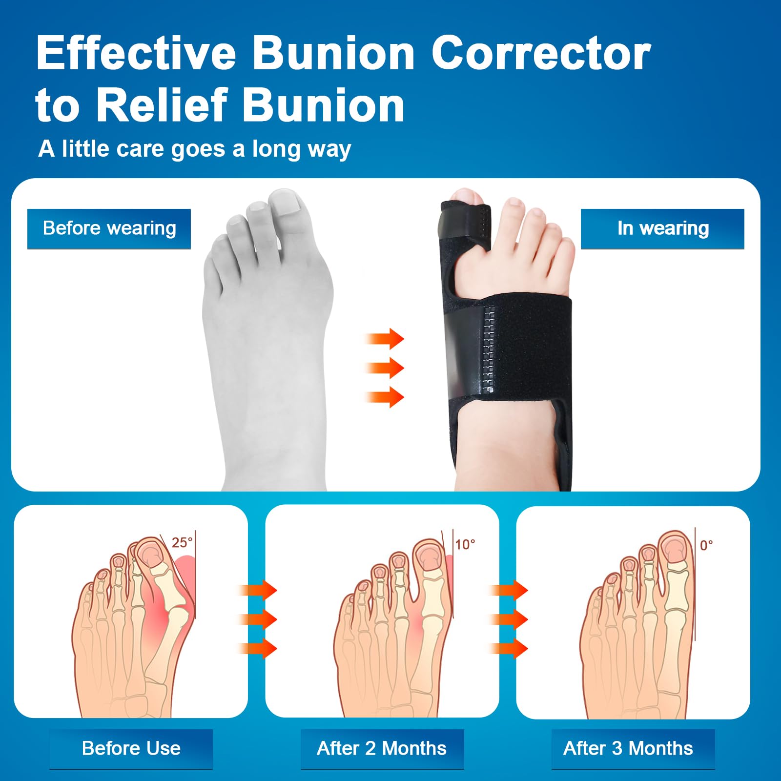 Hallux Valgus Korrektor für Frauen und Männer, Großzehenabstandhalter zur Linderung von Ballenzehen, Zehenspreizer für Hallux Valgus, 2 Einstellbare Korrektur, Korrektur, Zehenkorrektur