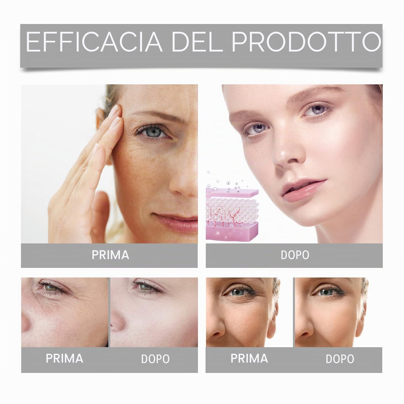 Sistema di Microinfusione Viso e Labbra – Siero con Acido Ialuronico Intensivo, Idratante e Antirughe, Trattamento Schiarente Professionale, Sistema di Micro-Infusione per Labbra per Pelli Sensibili