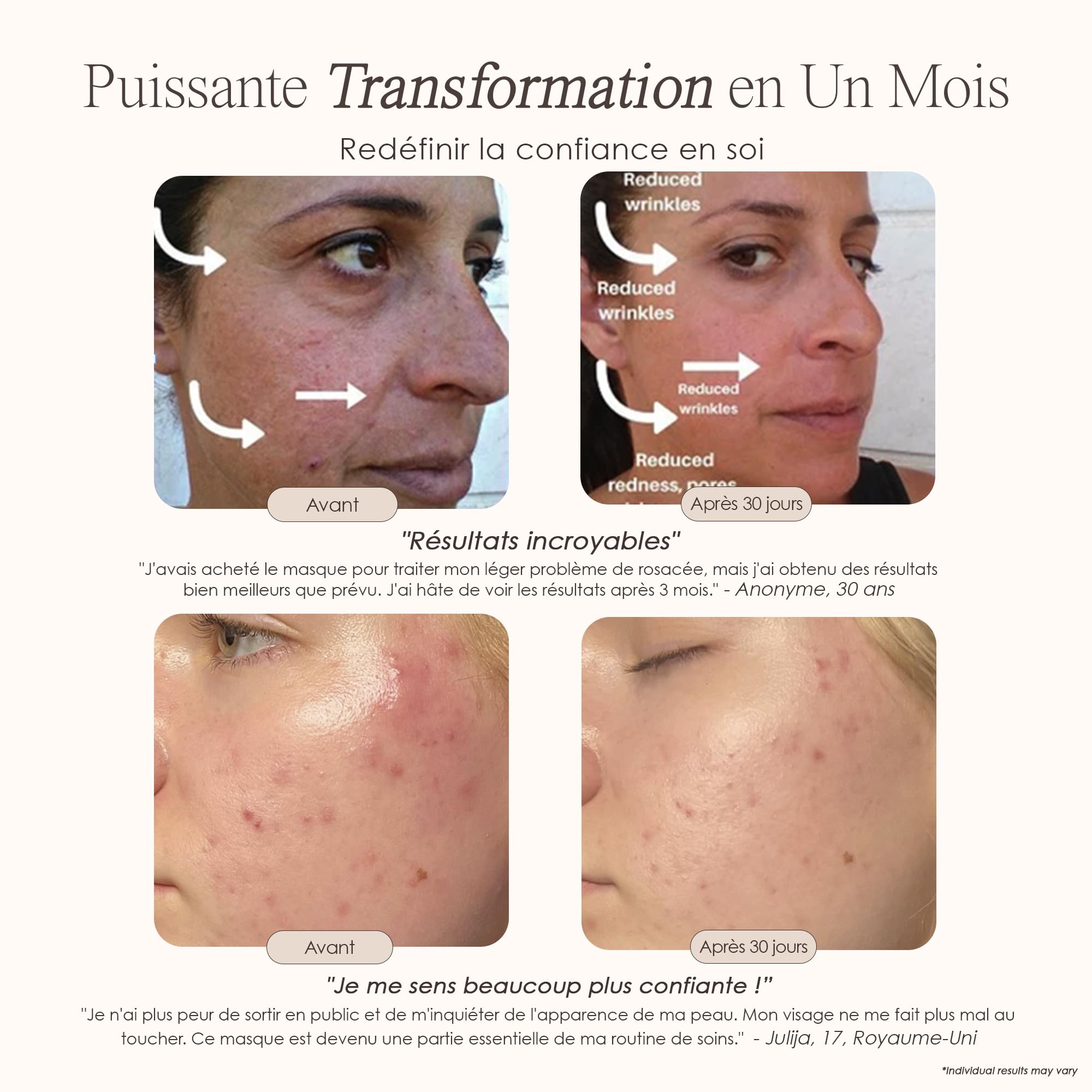 Masque de visage Luminothérapie 7 couleurs par Project E Beauty | Routine de Soins du Visage Anti-âge |Raffermissement de la Peau | Calmer l'Inflammation et la Peau Sensible |