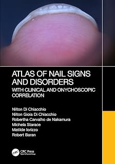 Atlas of Nail Signs and Disorders with Clinical and Onychoscopic Correlation
