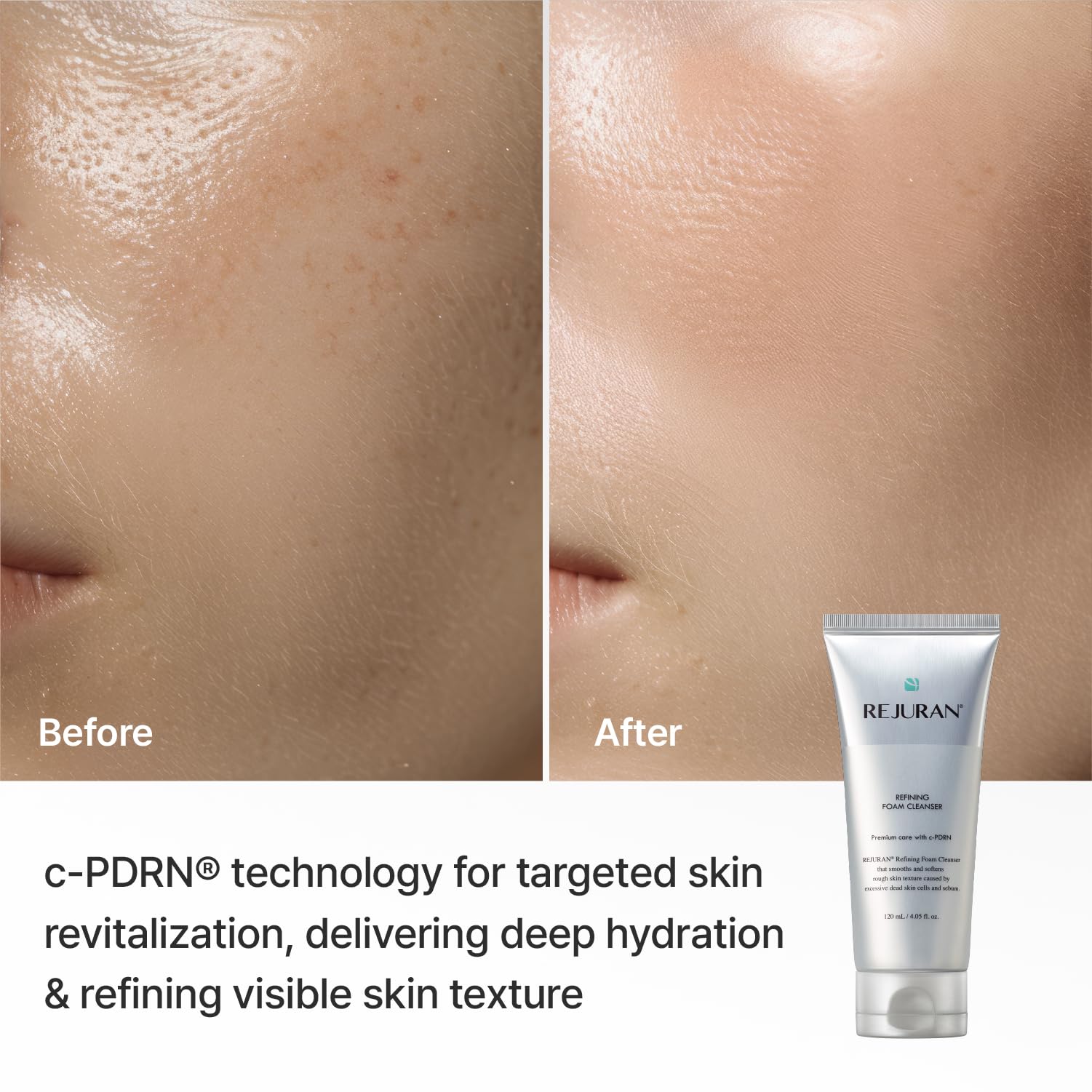 REJURAN Detergente Schiumogeno Purificante, Idratante E Delicato Per Una Pelle Più Liscia E Pulita, Minimizza I Pori E Riequilibra 4,05 fl oz (confezione da 1)