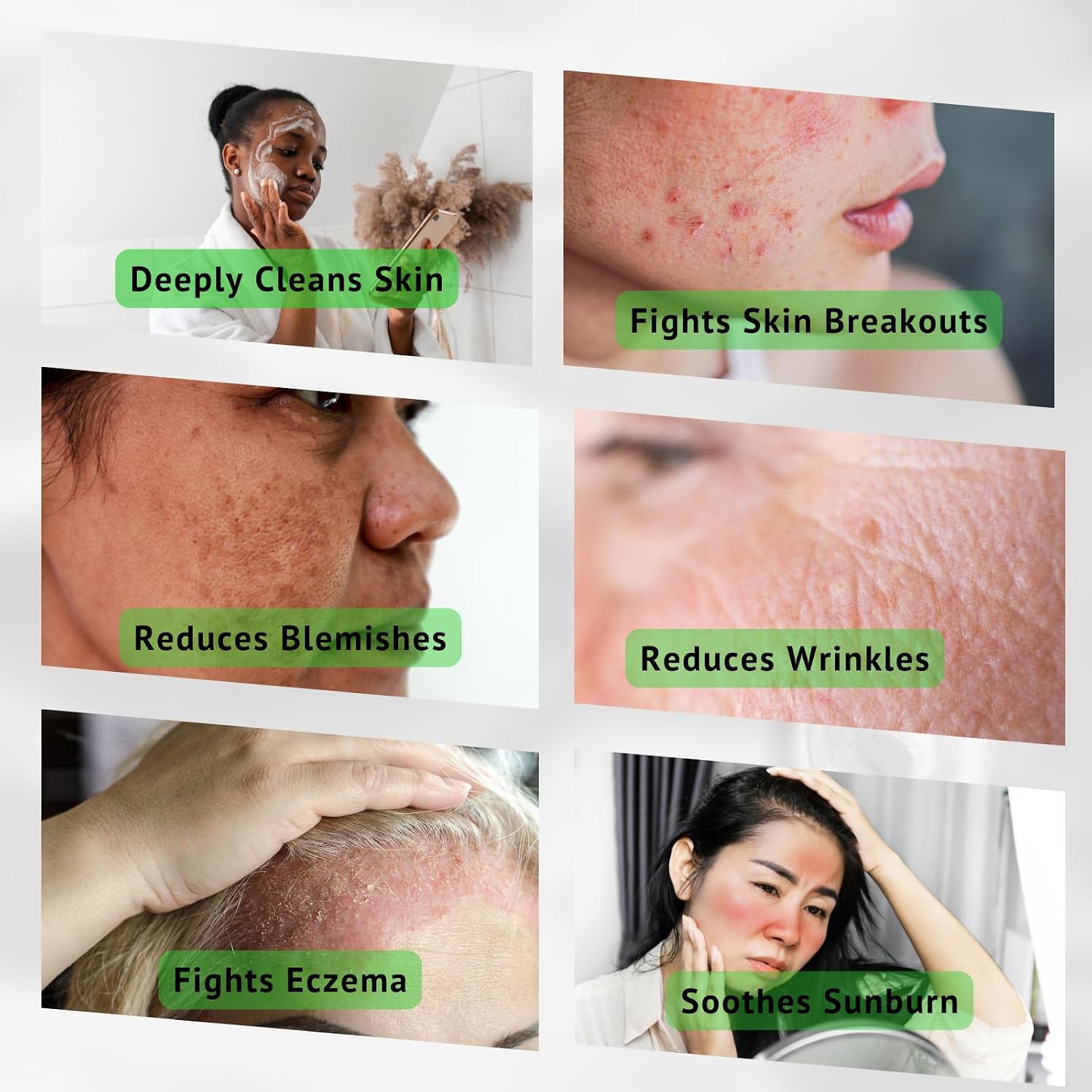 Aloe Vera Gel Cleanser, For Dry & Oily Skin. Treat & Prevent Acne, Dark Spots & Eczema. Face Wash for Men and Women.